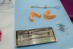 Протезирование зубов: съемные зубные протезы