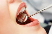 Протезирование зубов: сроки после удаления, привыкание, уход за протезами